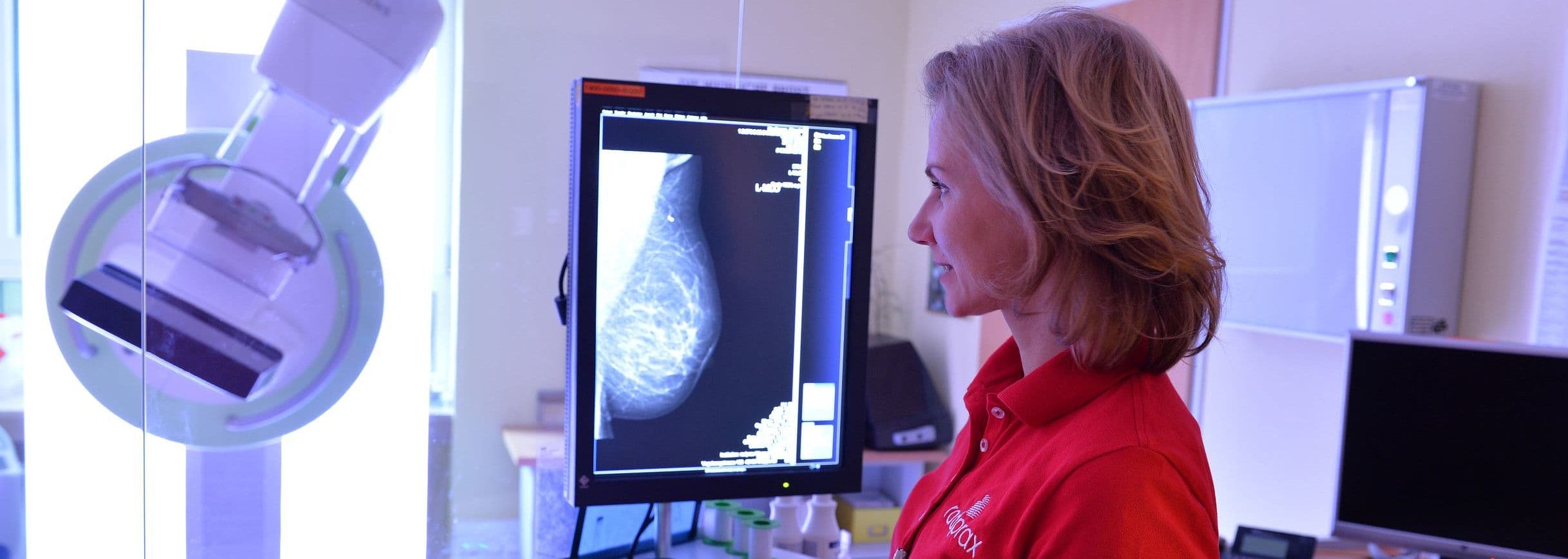 Mammography Screening