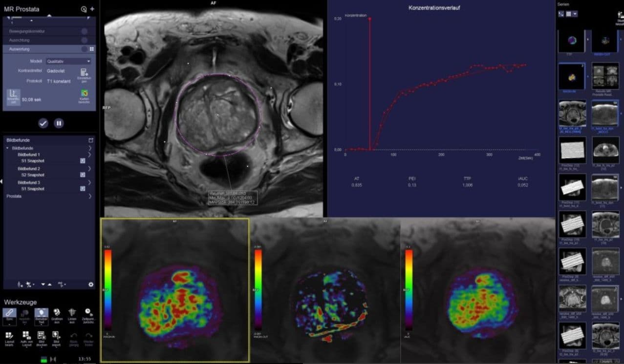 image for Prostate Diagnostics